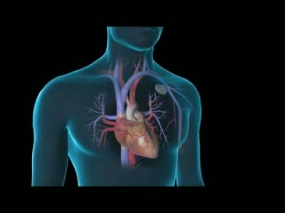 Kalp Pili Animasyonu